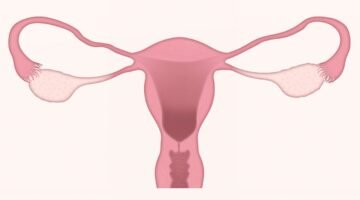 6 sinais de que sua menstruação vai descer em breve